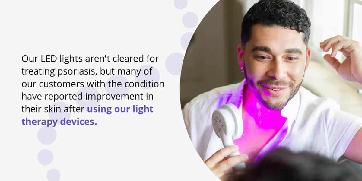 Our LED lights aren't cleared for treating psoriasis, but many of our customers with the condition have reported improvement in their skin after using our light therapy devices.