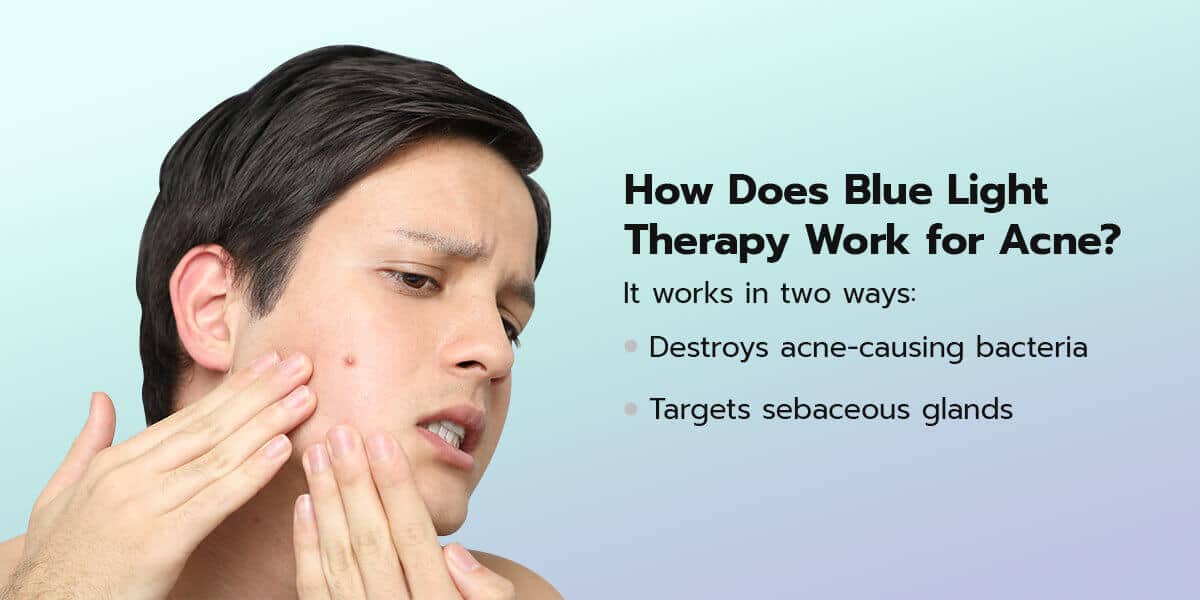How does blue light therapy work for acne? In two ways: it destroys acne-causing bacteria and targets the sebaceous glands