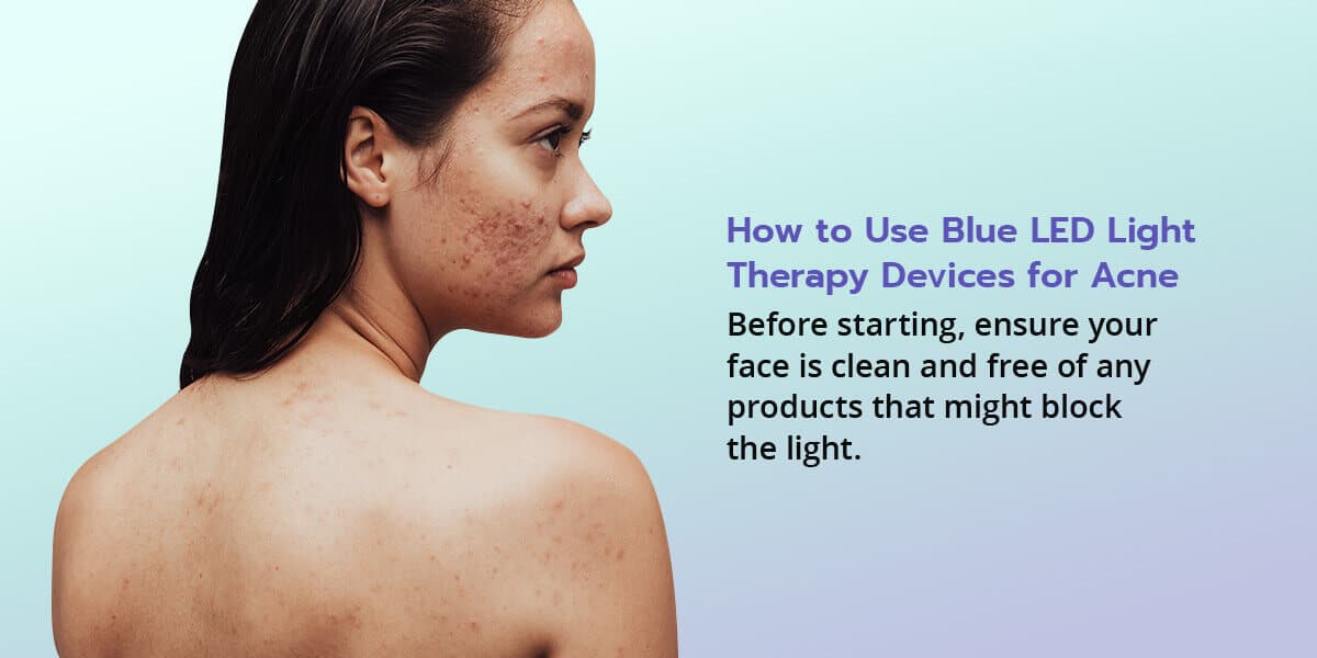 how to use blue led light therapy devices for acne