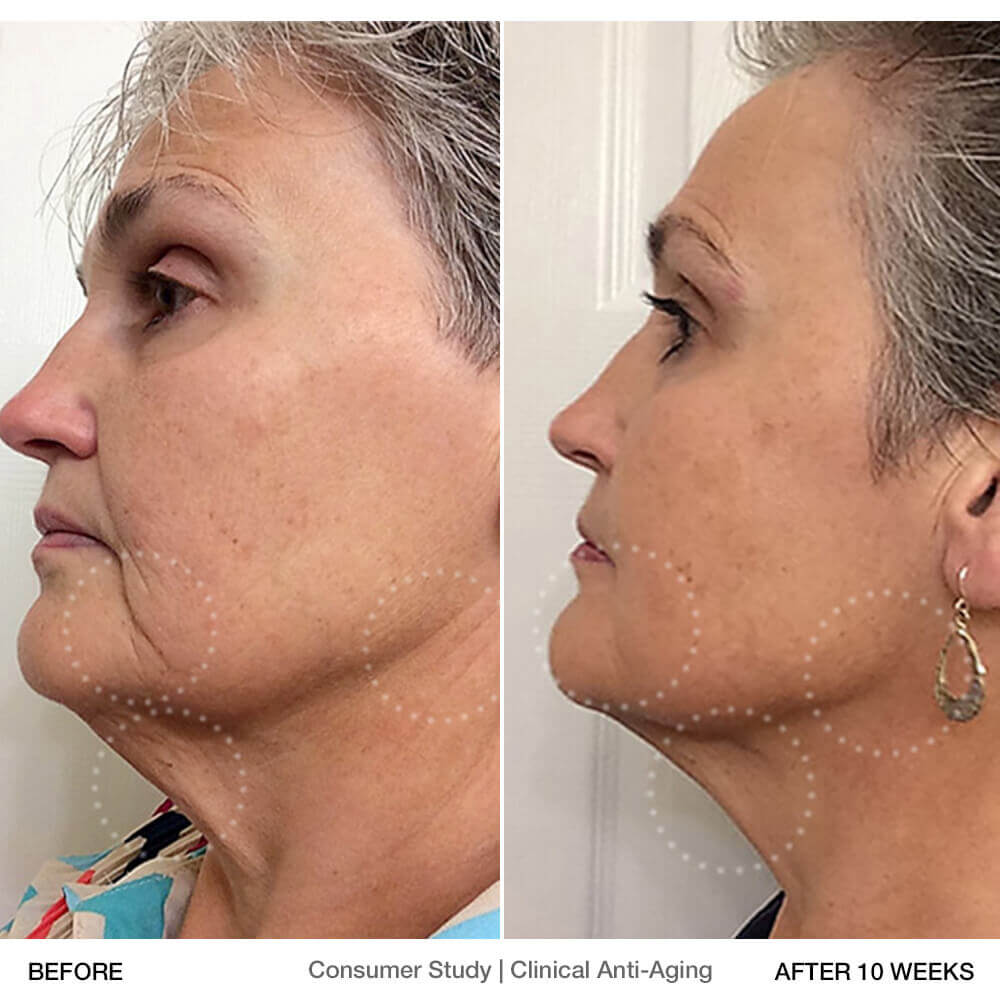 Clinical-Product-Page-Before-After