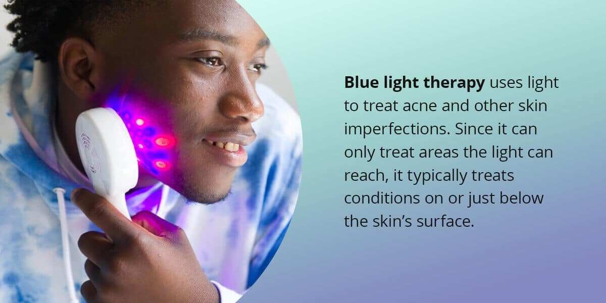blue light therapy uses light to treat acne and other skin imperfections. Since it can only treat areas the light can reach, it typically treats conditions on or just below the skin's surface
